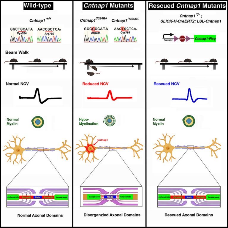 Gene Therapy Holds Promise For Paralysis Caused By Cntnap Mutations