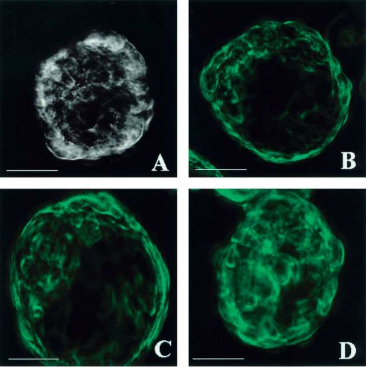 3D spheroid structures transduction. (Castillon, et al., 2004)