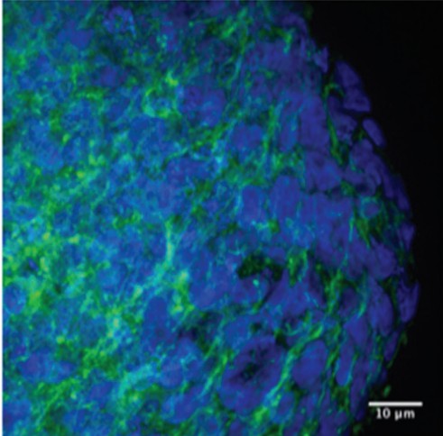 Tumor spheroids. (Raghavan, et al., 2016)