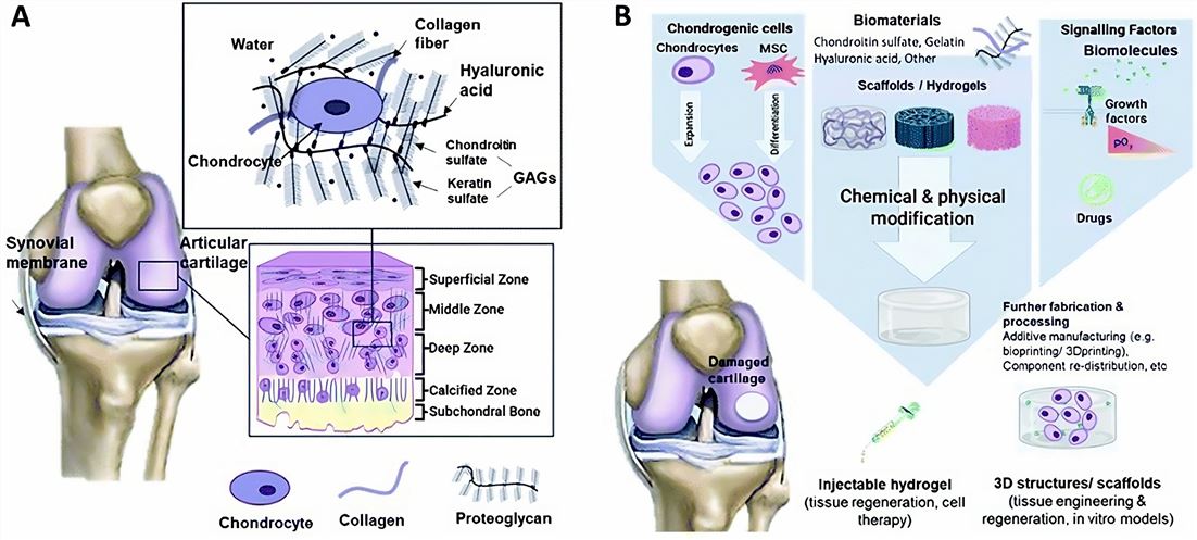 Schematic illustrations of (A) cartilage composition and typical tissue zones and (B) the tissue engineering approach for cartilage repair. (Kresanti, et al., 2021)