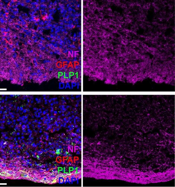 Differentiation of oligodendrocytes in human cortical spheroids. (Madhavan,2018)