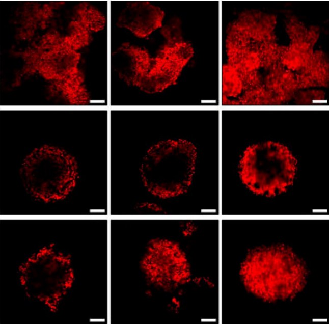 Hepatic stellate cell spheroids for tumor research. (Song, et al., 2016)