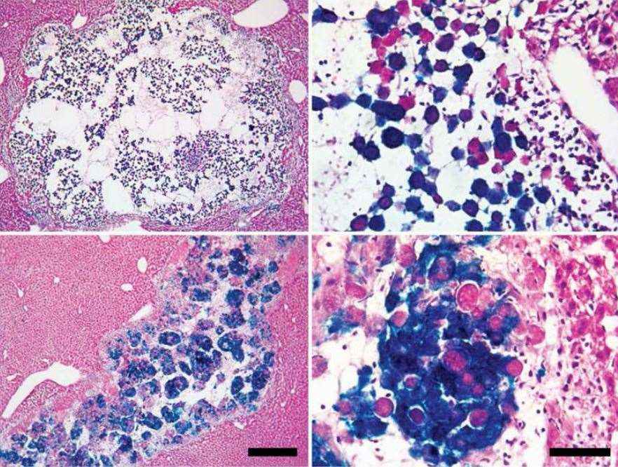 Cytospheroid histology. (Zhou, et al., 2016)