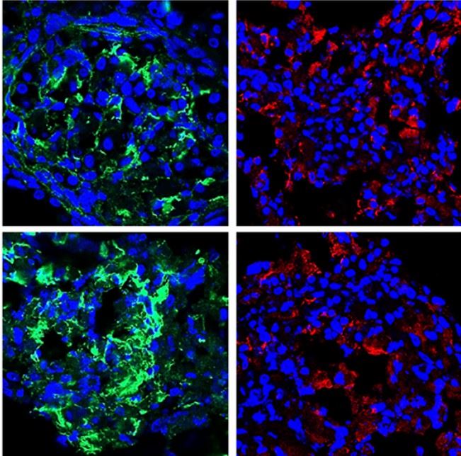 Human hepatic stellate cell spheroid. (Li, et al., 2022)