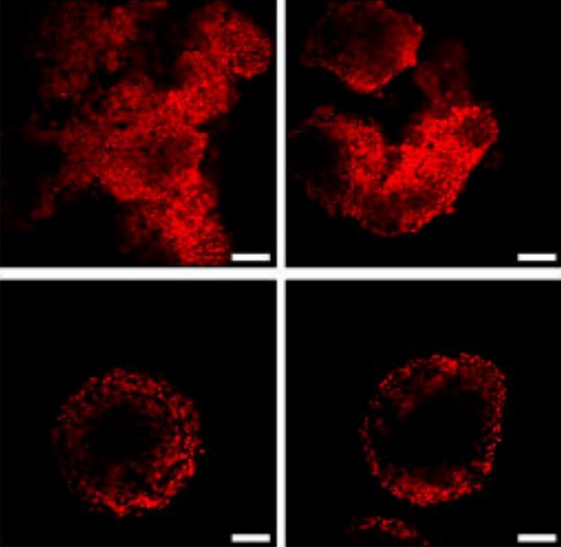 Hepatic stellate cell spheroid aggregation. (Song, et al., 2019)