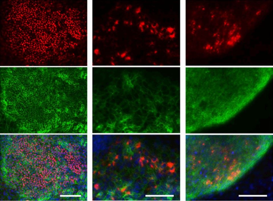 Stepwise induction of differentiated alveolar epithelial cell spheroids. (Gotoh, et al., 2014)