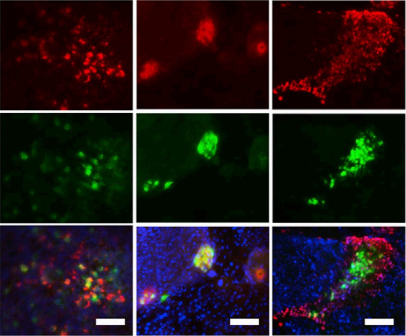 Alveolar epithelial cell spheroids. (Gotoh, et al., 2014)