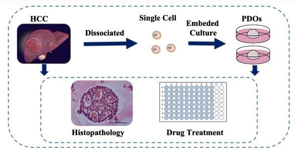 Establishment of HCC PDOs in vitro. (Wang, 2020)