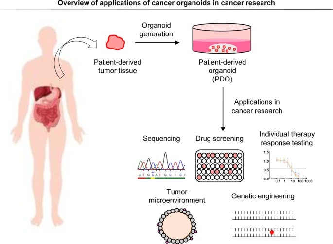 Applications of cancer organoids in cancer research. (Seidlitz, 2021)