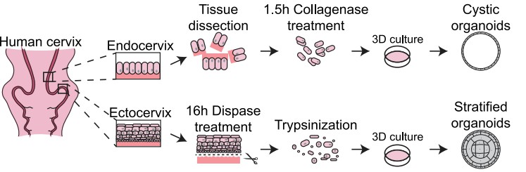 Establishment of organoids from endo- and ectocervix. (Lõhmussaar, 2021)