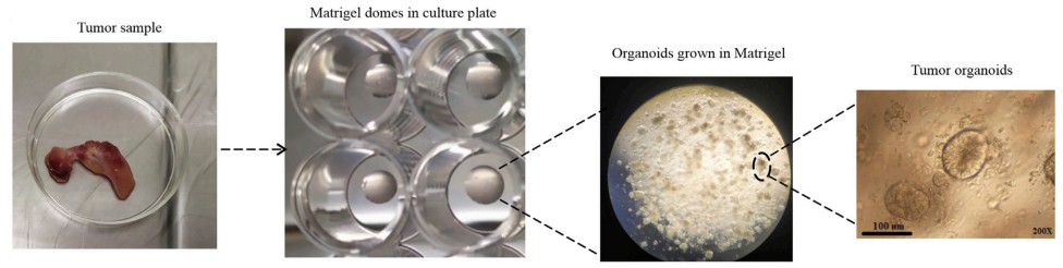 Establishment of colorectal cancer organoids. (Luo, 2020)