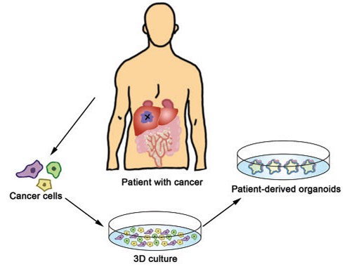 Generation of patient-derived organoids. (Yang, 2018)