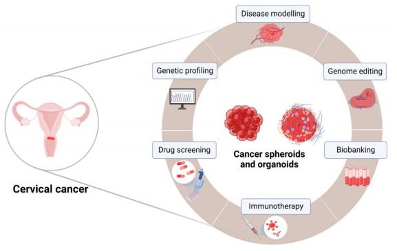 Perspectives for application of 3D models in personalized cervical cancer therapy. (Kutle, 2023)