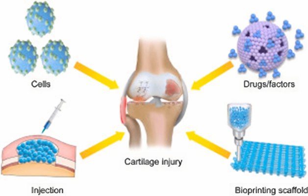 Cartilage-on-a-chip Model Introduction