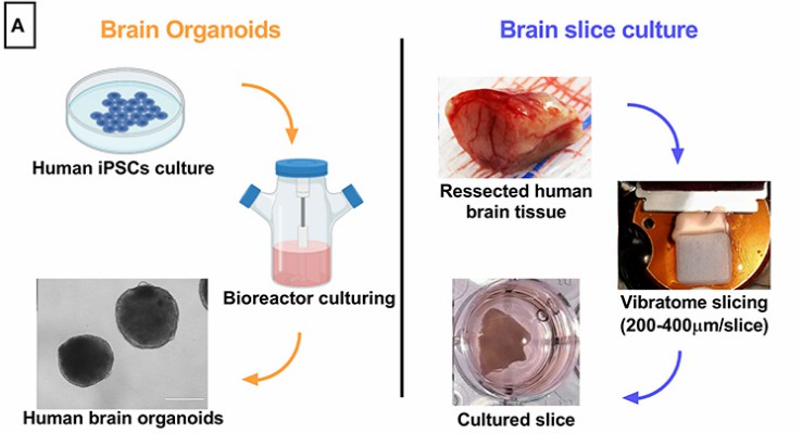 Tridimensional human brain-derived models comparative.