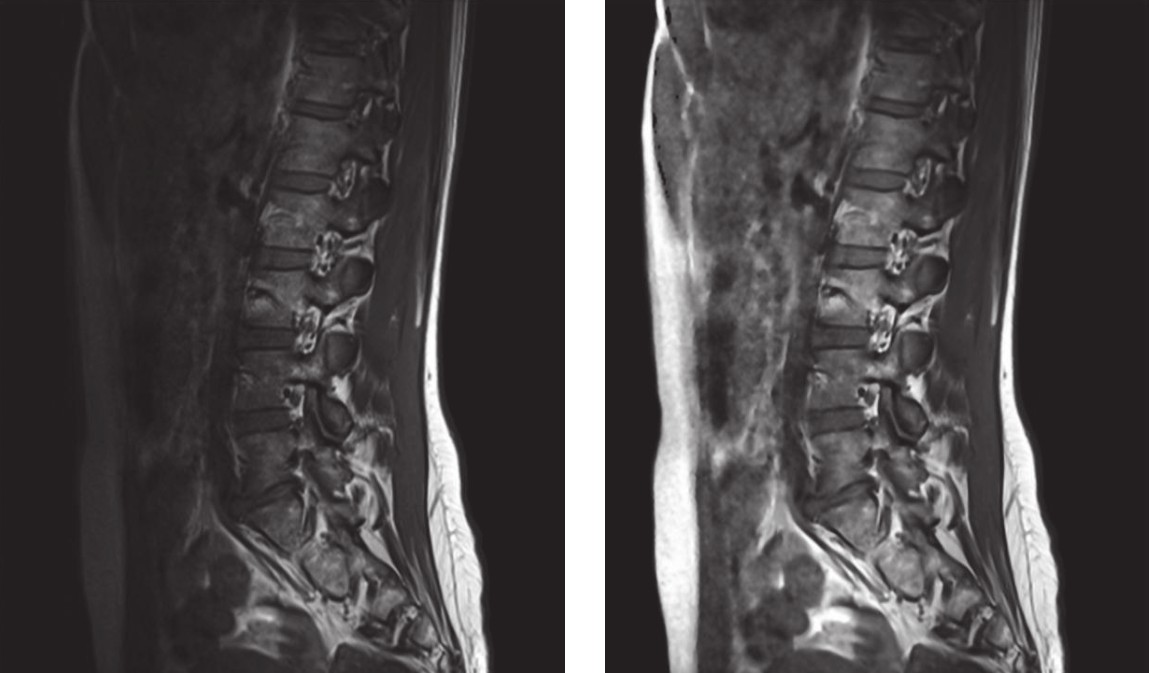 Human vertebral column.