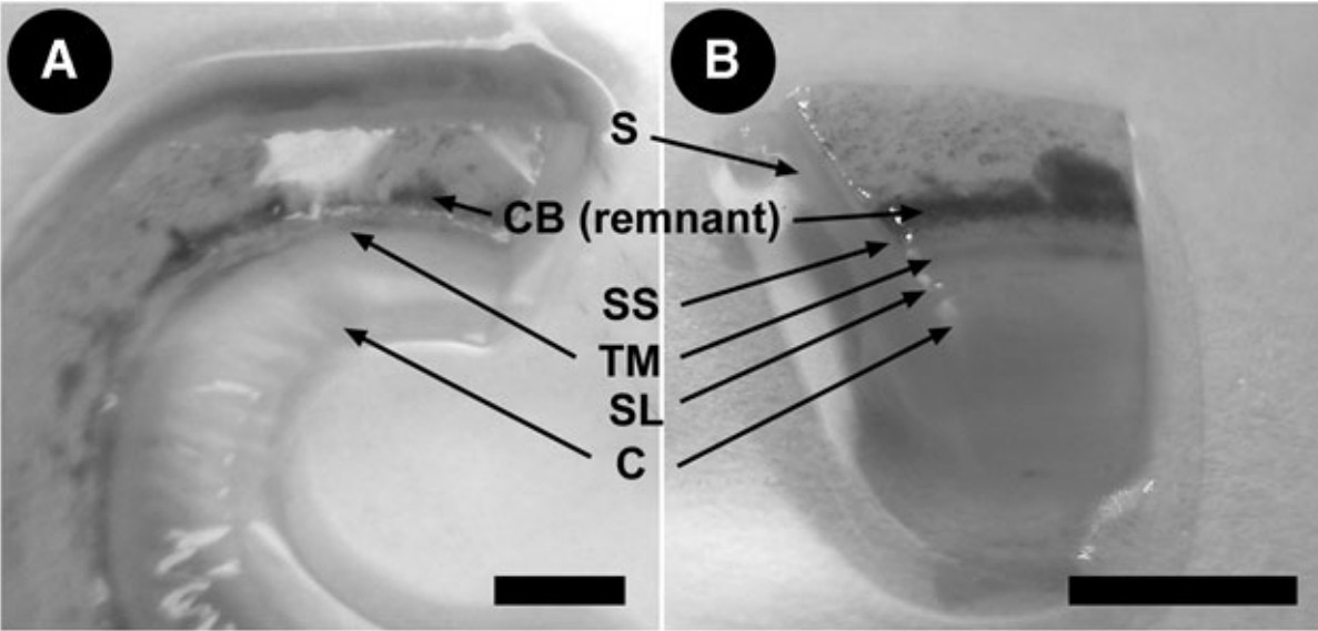 Corneoscleral rims from a human donor.