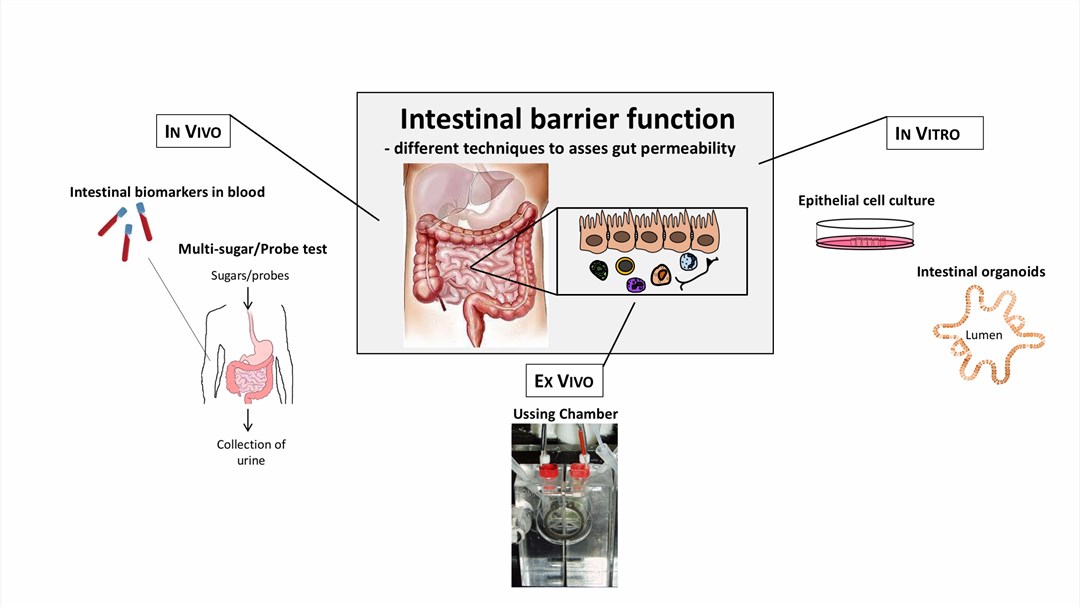 Strategies for the assessment of gut permeability.