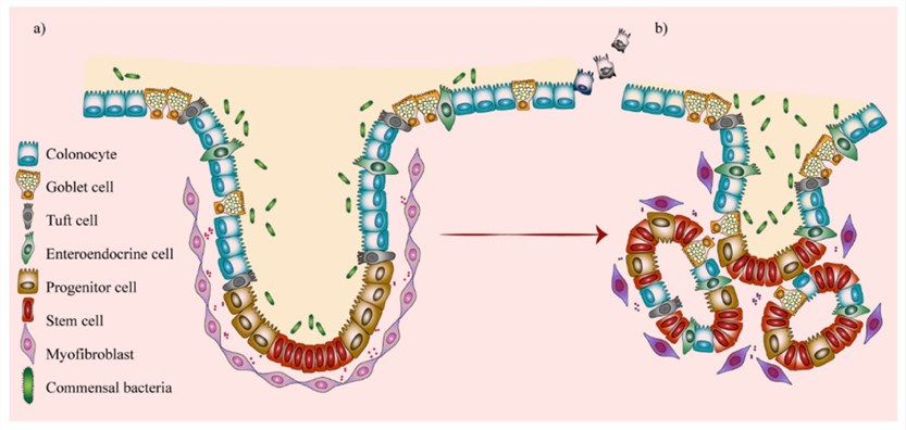 The organization of the colon crypt and the transition to carcinoma.