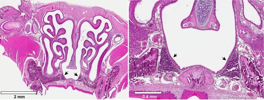 Nasal-associated lymphoid tissue.