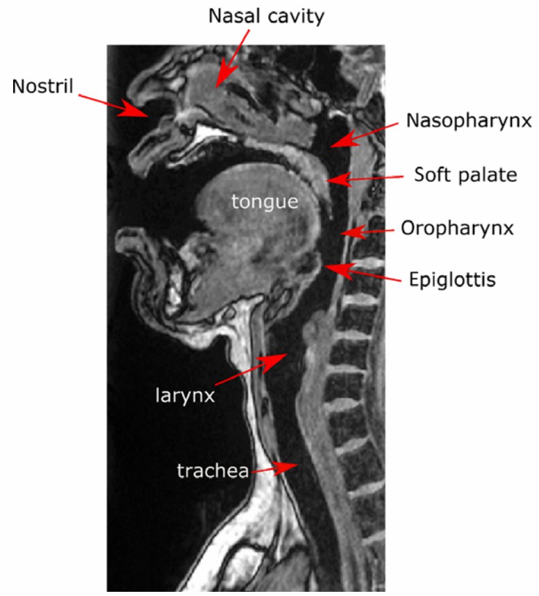 MRI image of the human upper respiratory tract.