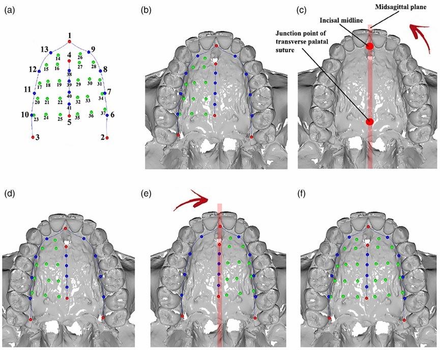 Human palatal arch tissue model with landmarks.