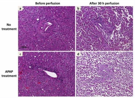 Liver and liver perfusion.