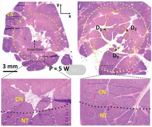 Human embryonic pancreas. (Jennings, 2015)