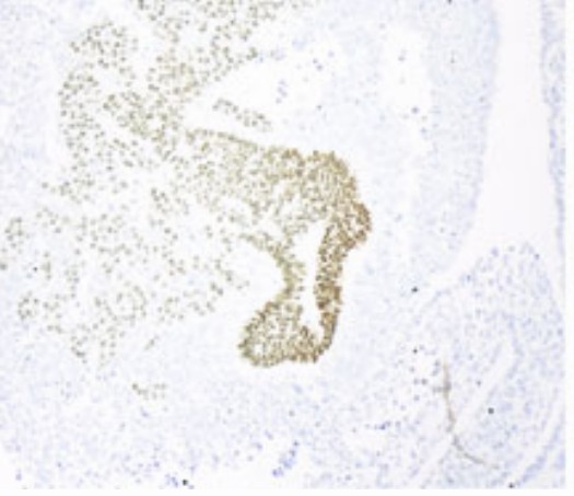 Histological assessments of pancreatic tissue. (Truong, 2021).