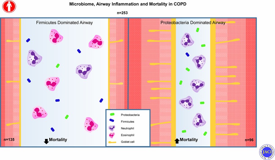 Microbiome Airway Inflammation and Mortality in COPD.