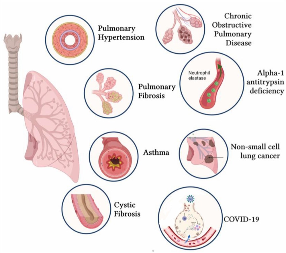 Respiratory diseases.