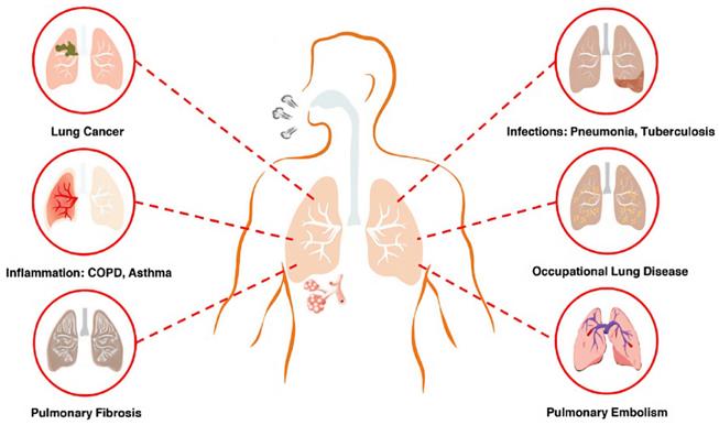 Common respiratory diseases.