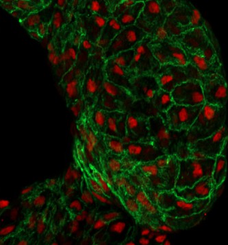 Cardiomyocyte fluorescent staining. (Narumanchi, 2022)