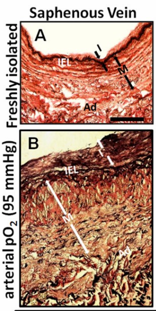 Saphenous vein. (Joddar, 2015)