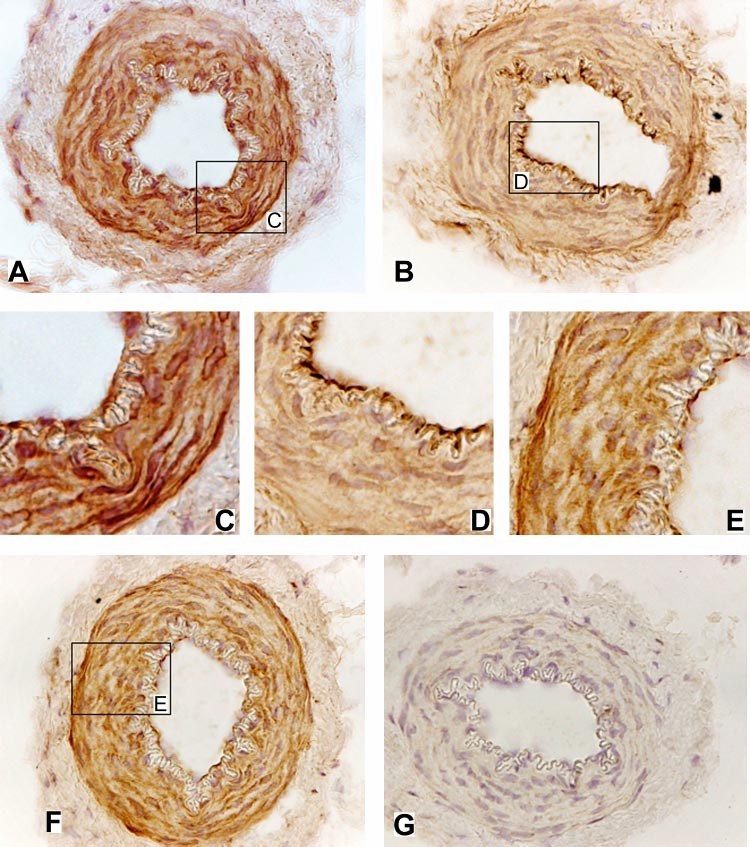 Human subcutaneous resistance arteries tissue.