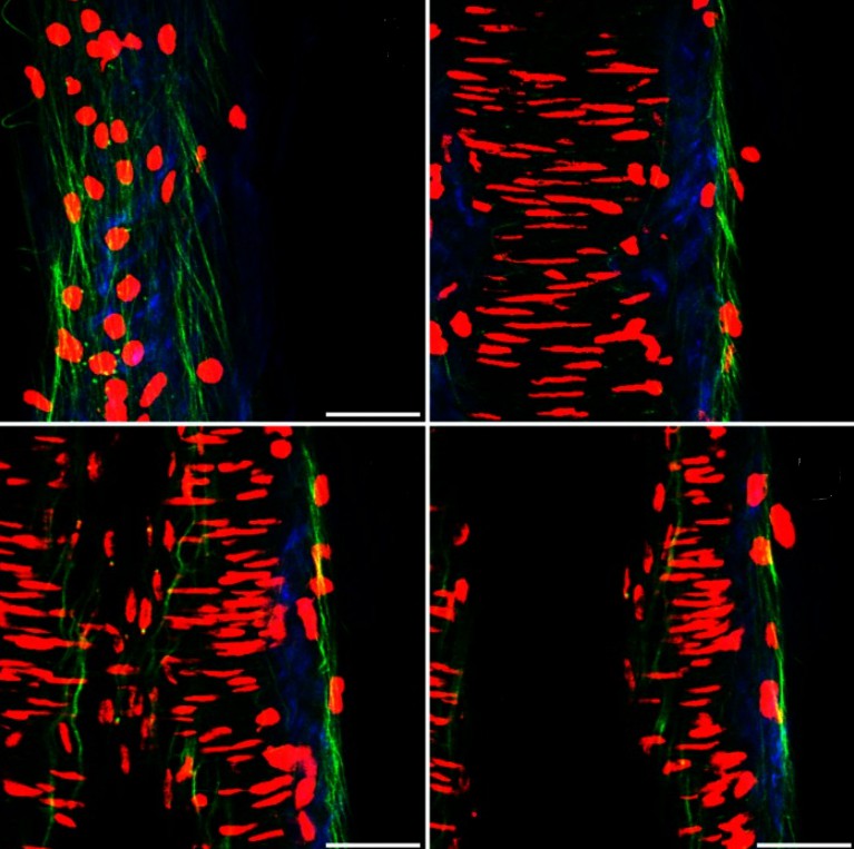 Collagen, elastin and cell nuclei stain images of artery vessel. (Bell, 2016)