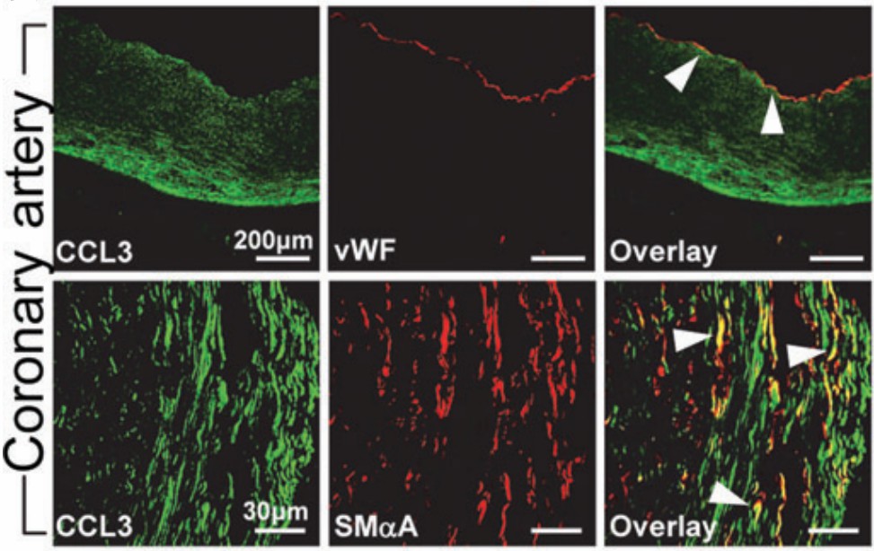 Fluorescein staining of coronary arteries. 