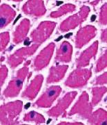 Histological analysis of pulmonary artery cells. (Bao,2022)