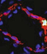 Fluorescent staining of pulmonary artery cells. (Bao,2022)