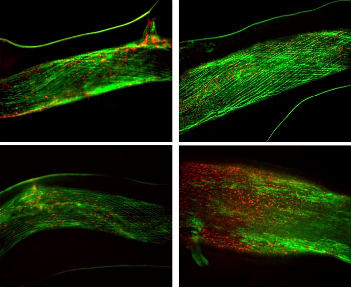 Human artery vasodilation and vasoconstriction.