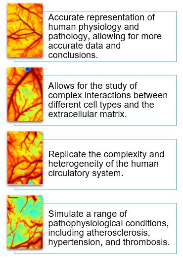 3D Ex Vivo Human Ischemic Arteries Model