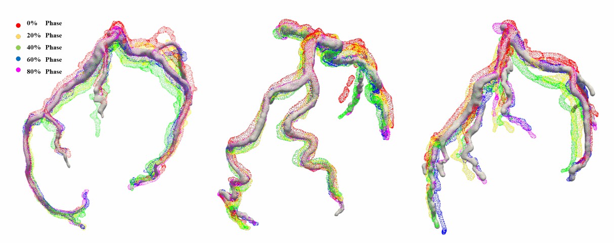 Left ascending coronary artery and left circumflex coronary artery.