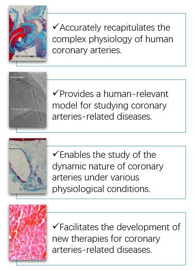 3D Ex Vivo Human Coronary Arteries Model