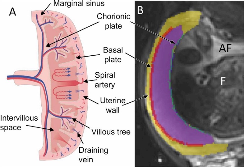 Human placenta blood flow.