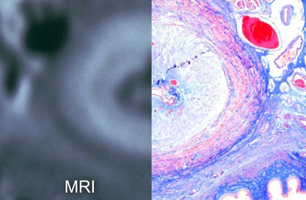 Traditional Models for Urethra Contraction Research