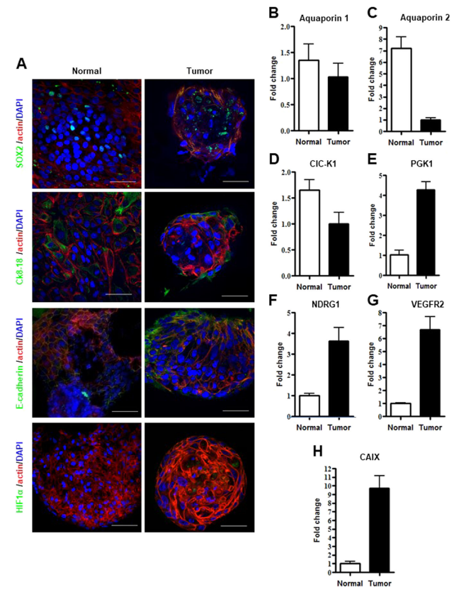 Characterization of 3D ex vivo renal disease models.