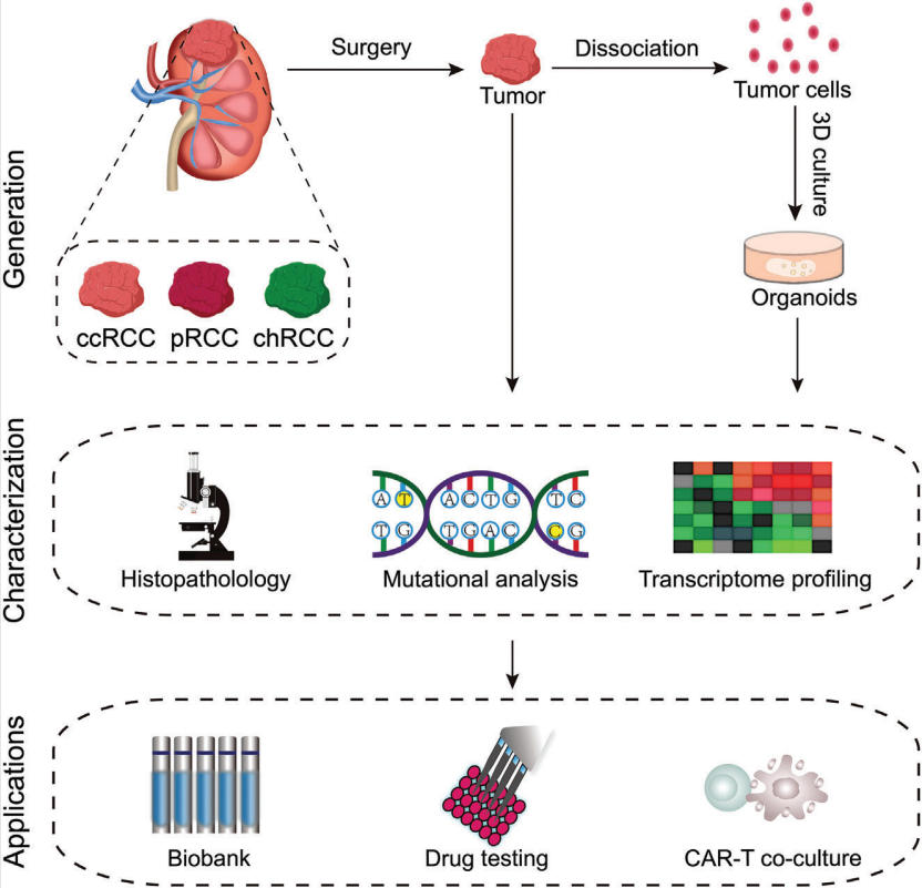 Efficient construction of patient-derived 3D renal cell carcinoma models.