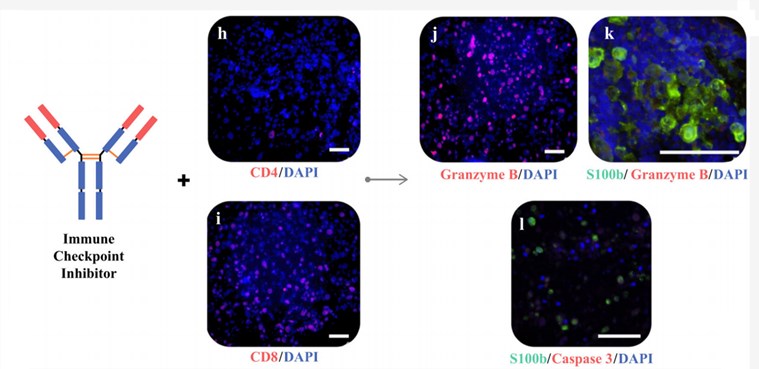 Immune enhancement induces T-cell activation and tumor killing.