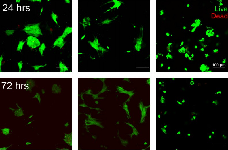 Fibroblasts cultured in different states.