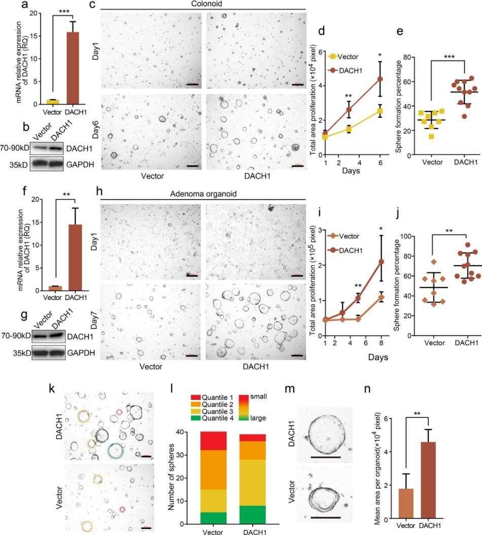 DACH1 overexpression enhances the growth of organoids derived from normal colon crypts and colorectal adenomas.